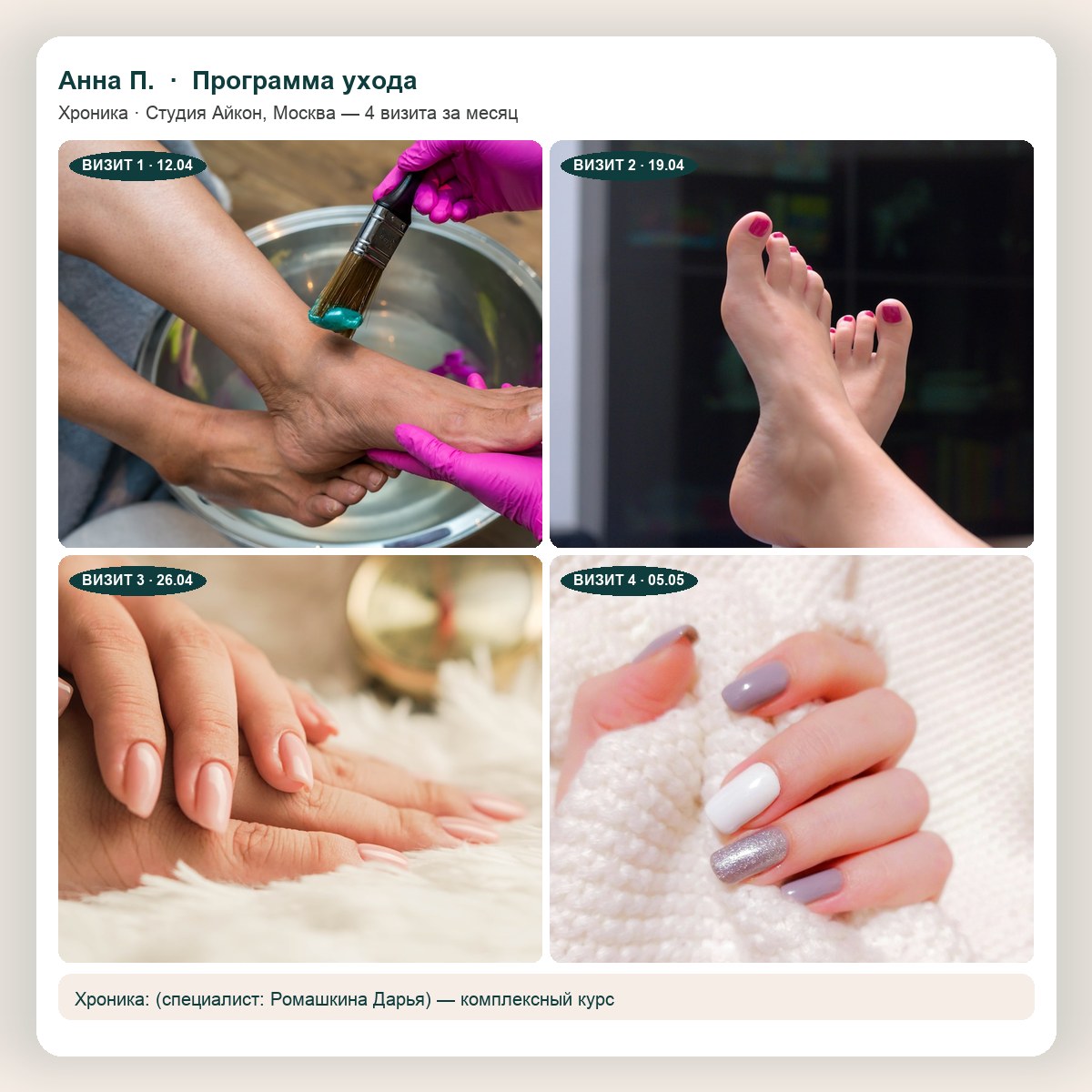 Коллаж 2×2 — динамика за 4 визита